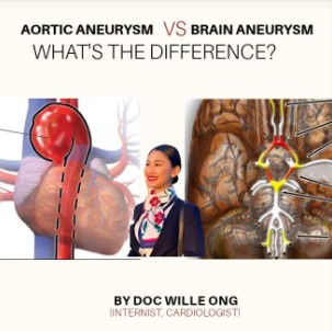 Photo of Aortic Aneurysm versus Cerebral Aneurysm