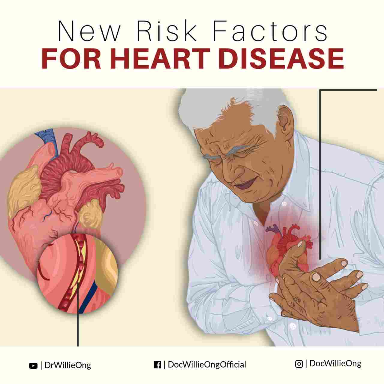 New Risk Factors For Heart Disease - Doc Willie Ong